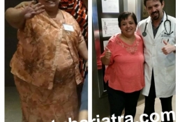 Tu Bariatra obesity treatment 33
